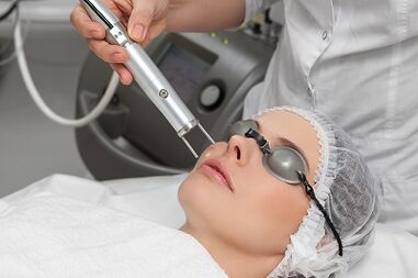 benefícios do rejuvenescimento a laser